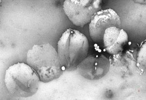 chylomicrons … negative staining chylomicrons … negative staining